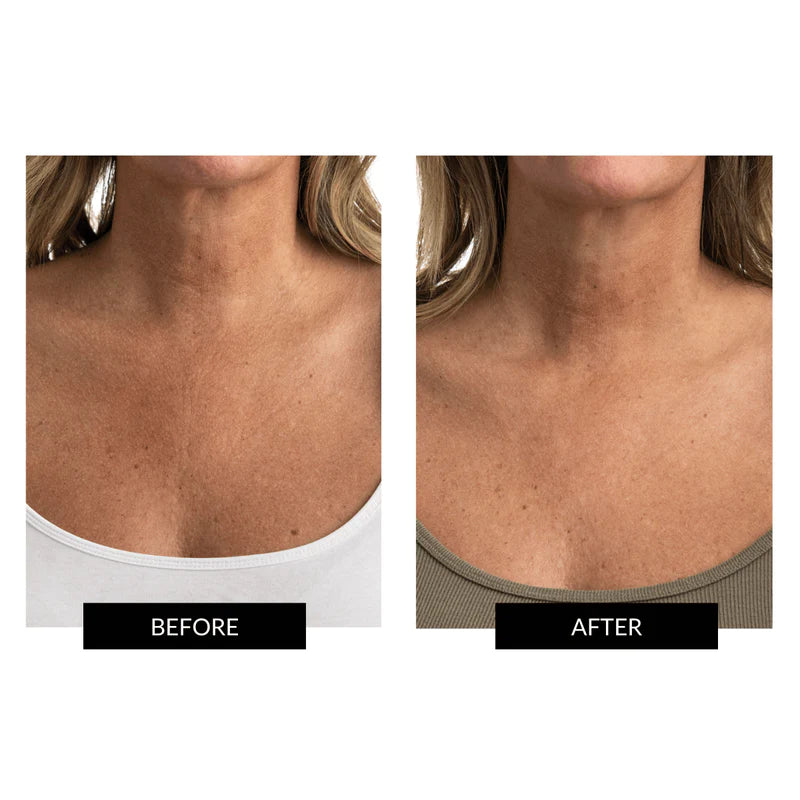 Skin LED Neck and Dec Perfector